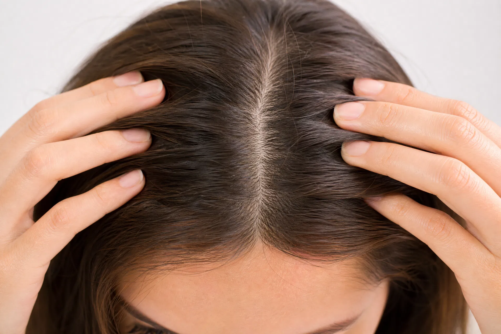 Healthy hair roots and scalp
