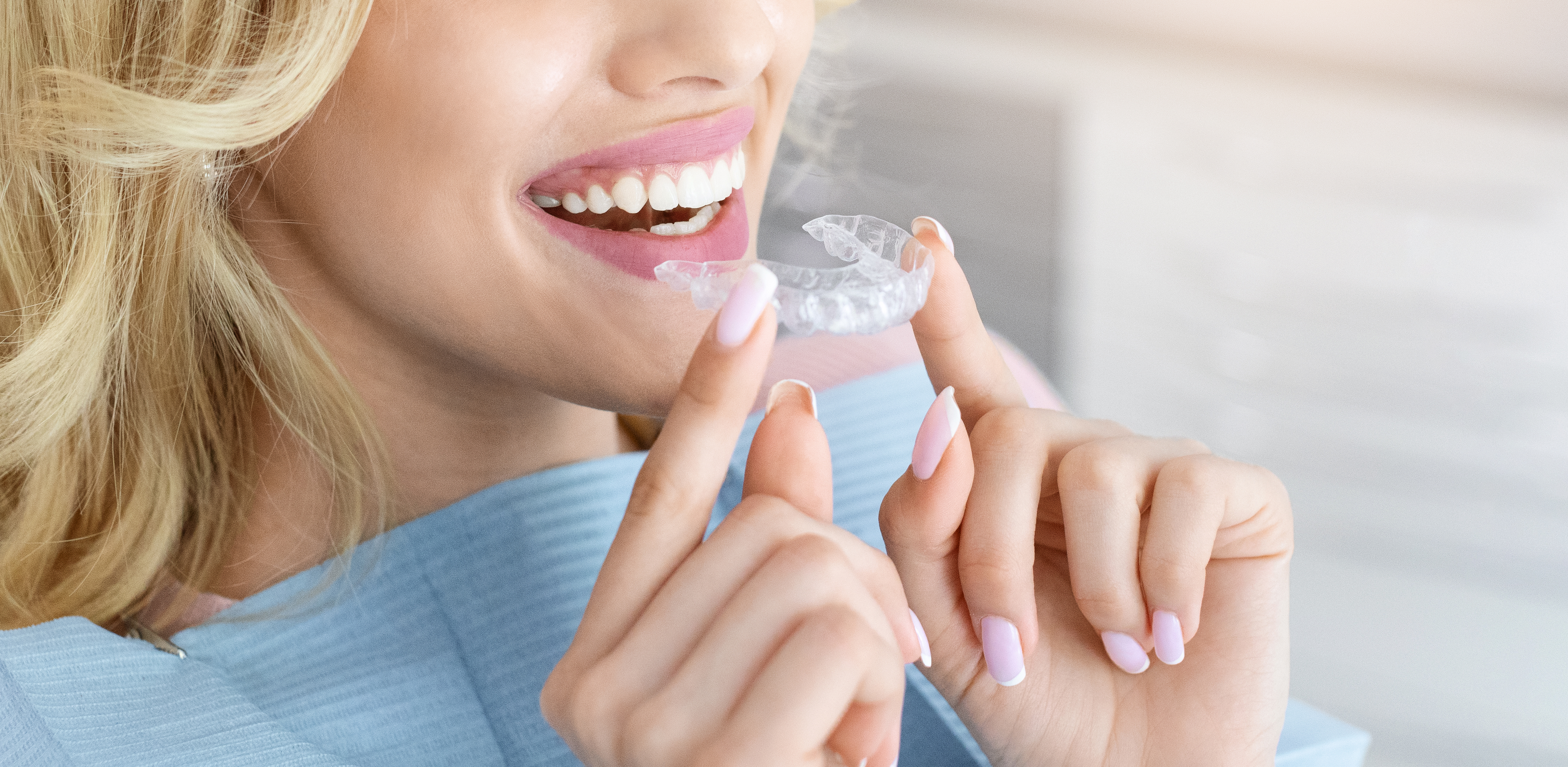 Clear Aligners