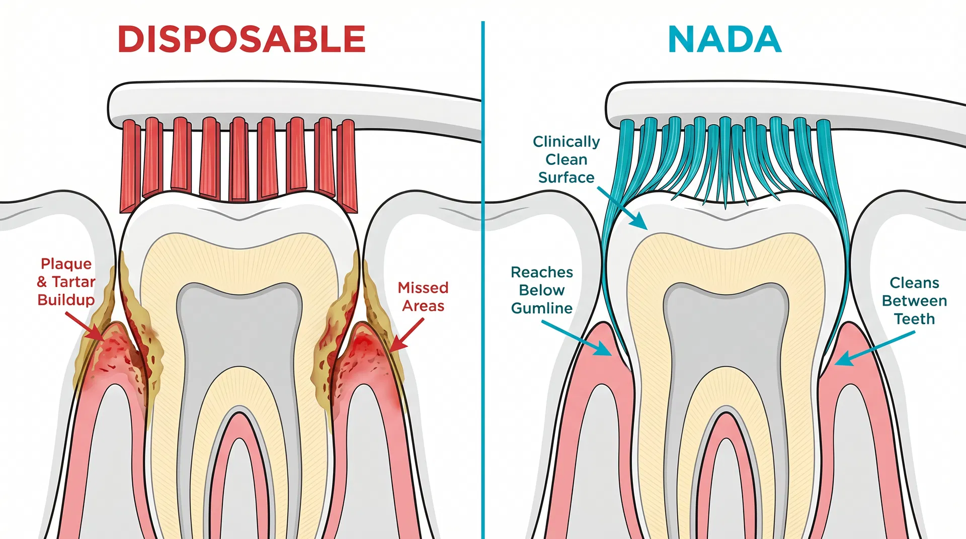 Flat-cut bristles leave plaque at gumline vs Nada floss-tip bristles reaching below