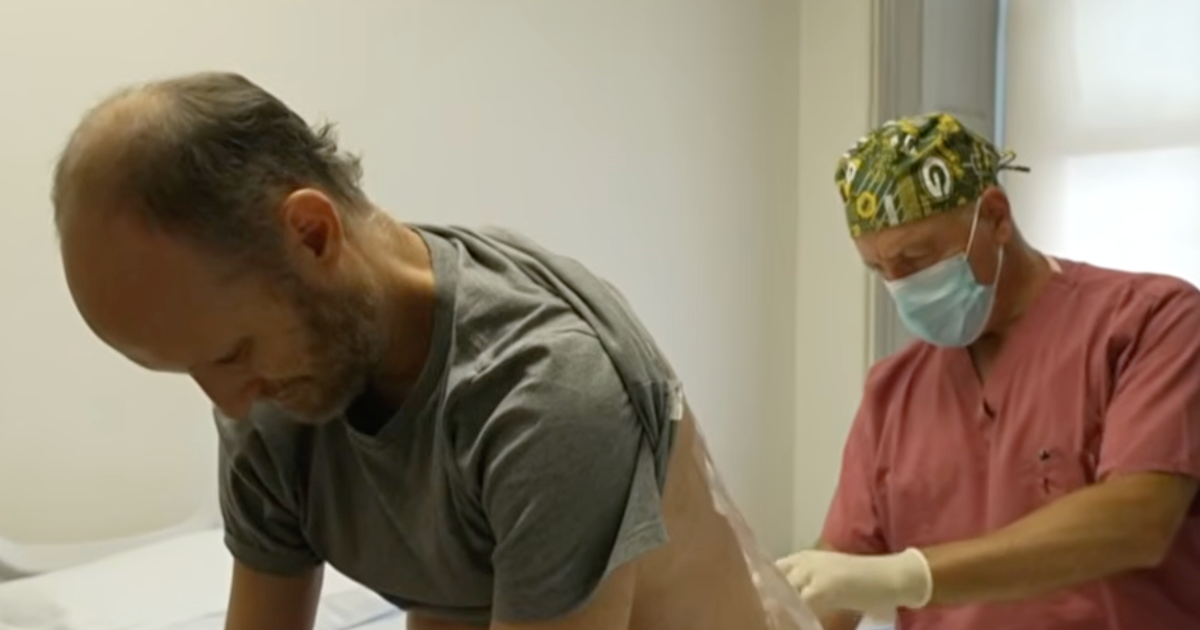 Scientist with rare ALS genetic mutation looks to experimental treatment