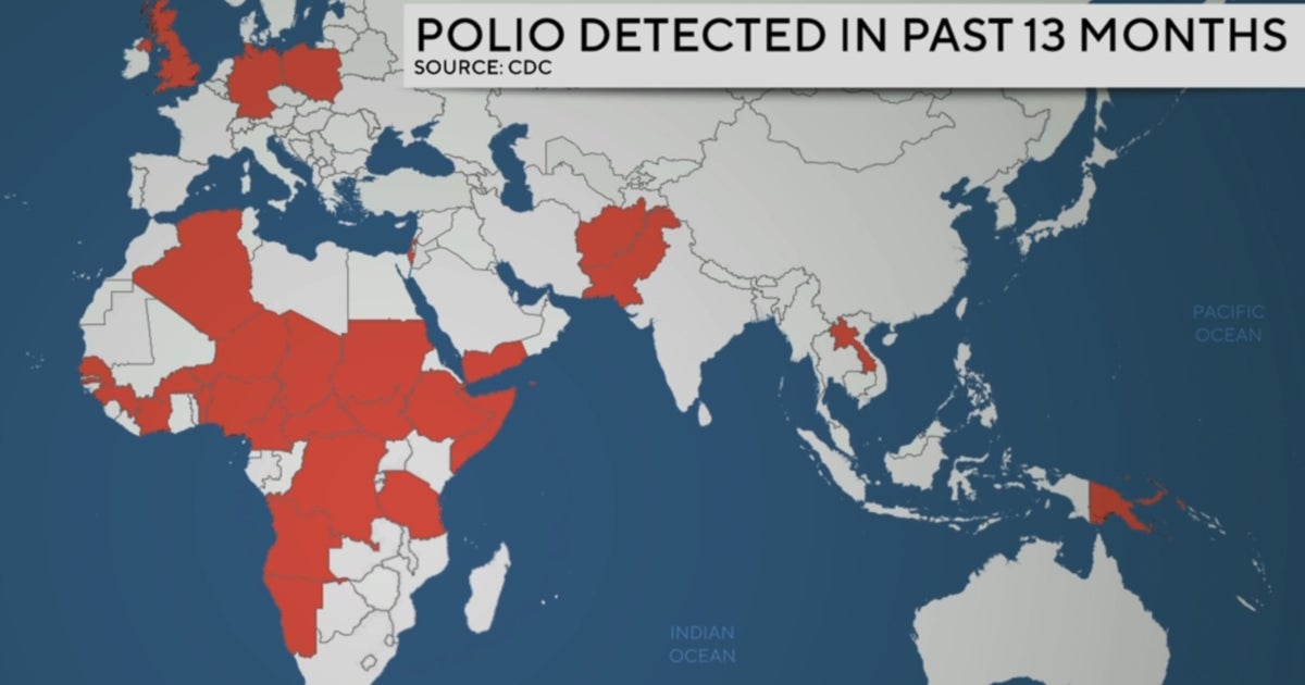 CDC issues new polio advisory for travelers