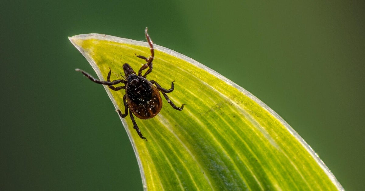 Tick season is sending more people to hospitals. Here's how you can protect yourself.