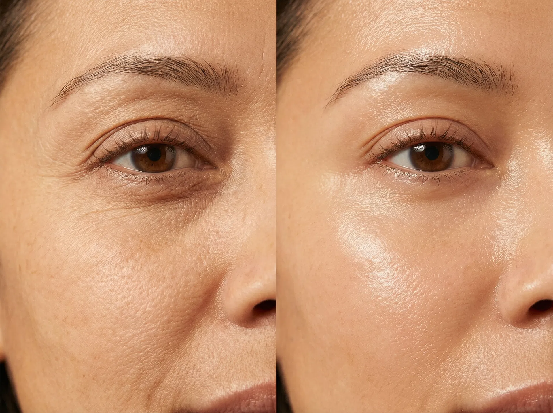 It Reduces The Appearance Of Wrinkles & Fine Lines