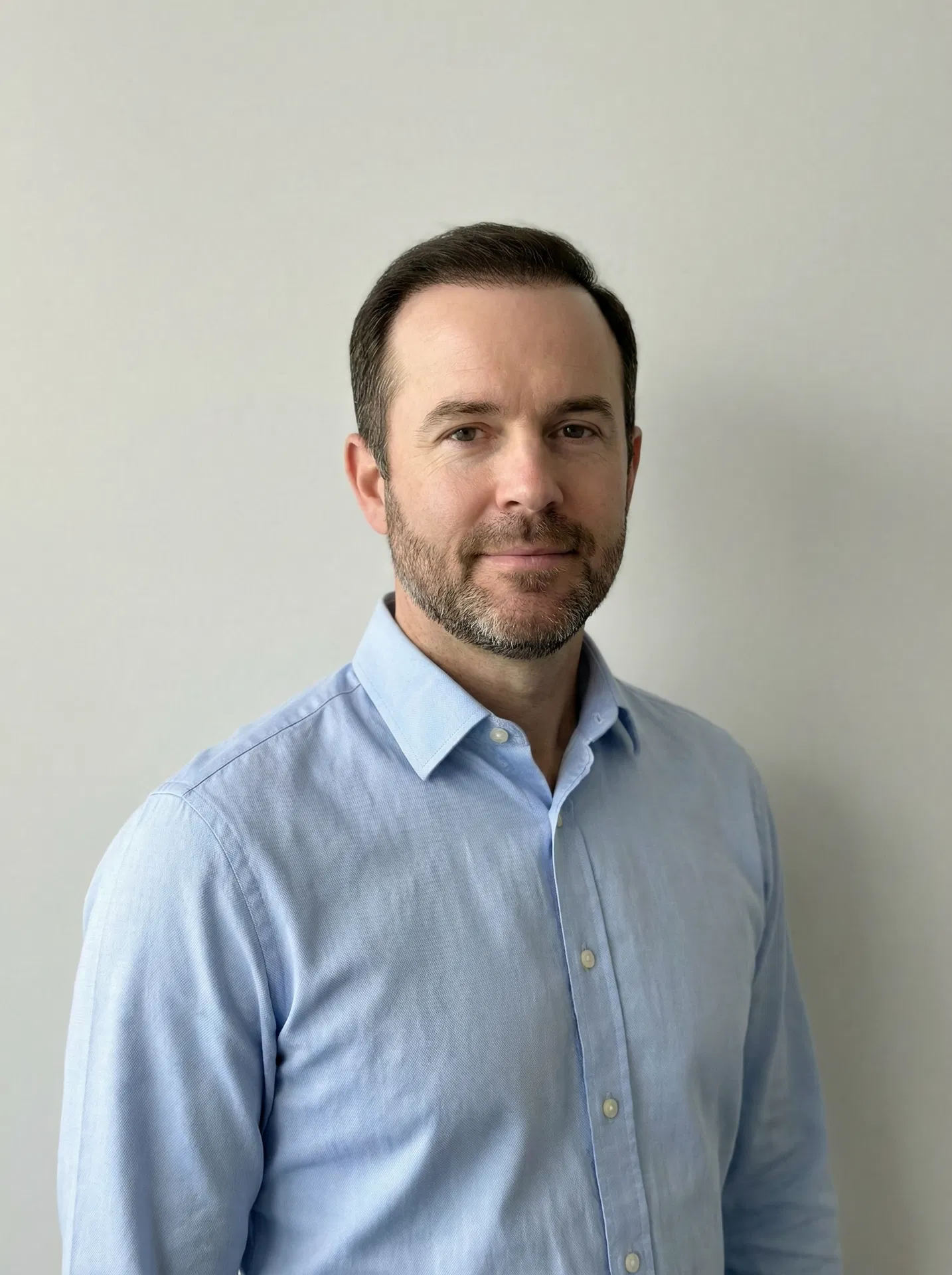 Same patient 12 months after hair transplant in Turkey with restored crown coverage front view against plain wall