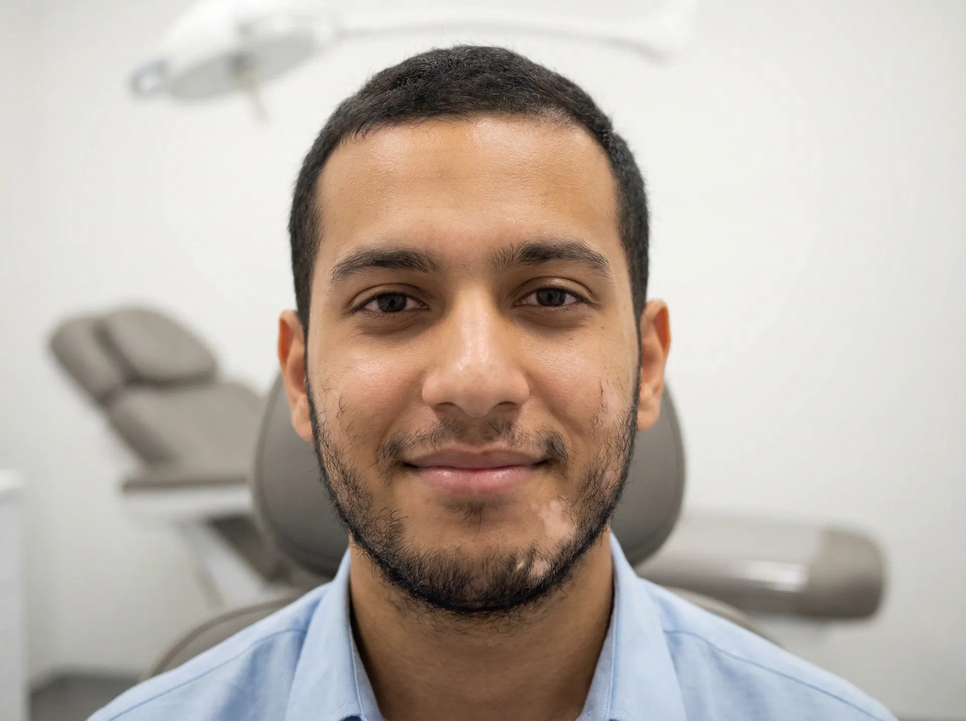A young man with a patchy beard sitting in a modern hair transplant clinic consultation room