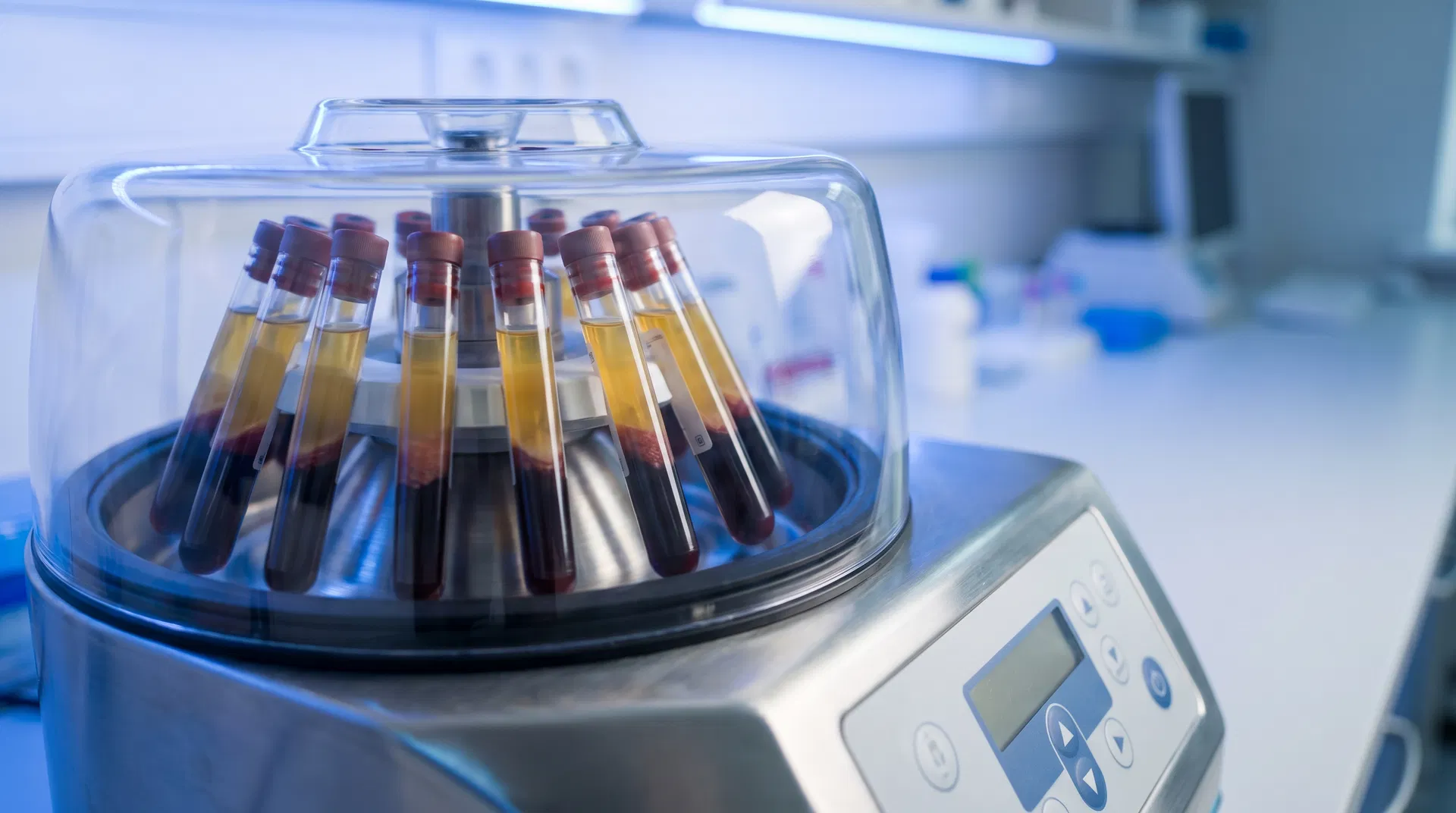 PRP centrifuge machine spinning blood samples with golden platelet-rich plasma visible