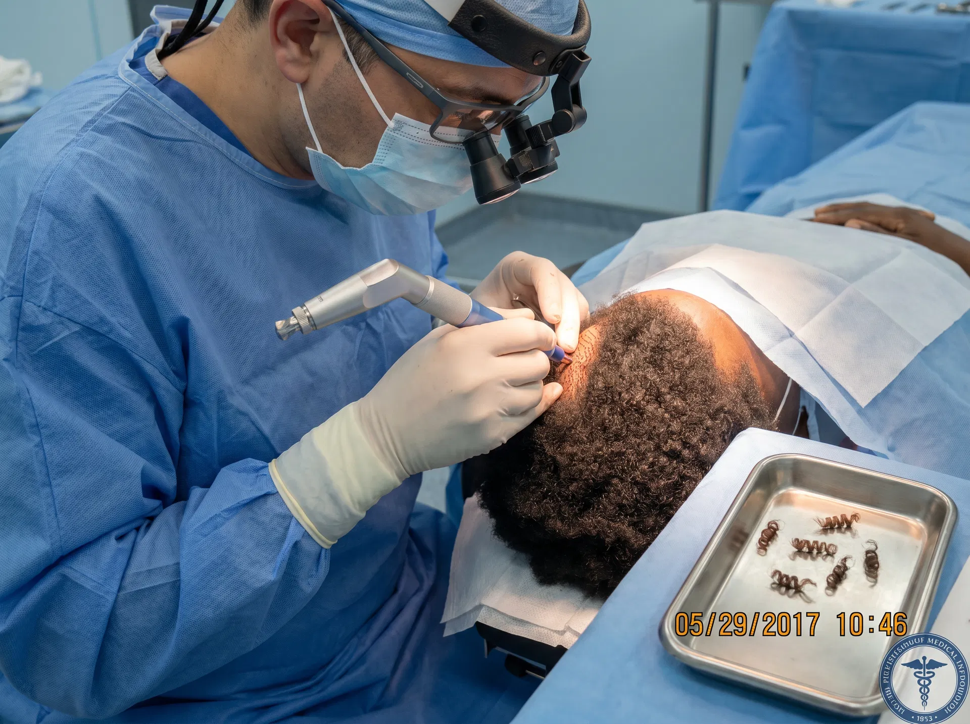 Afro Hair Transplant hair transplant technique offered at Asli Tarcan Clinic Turkey