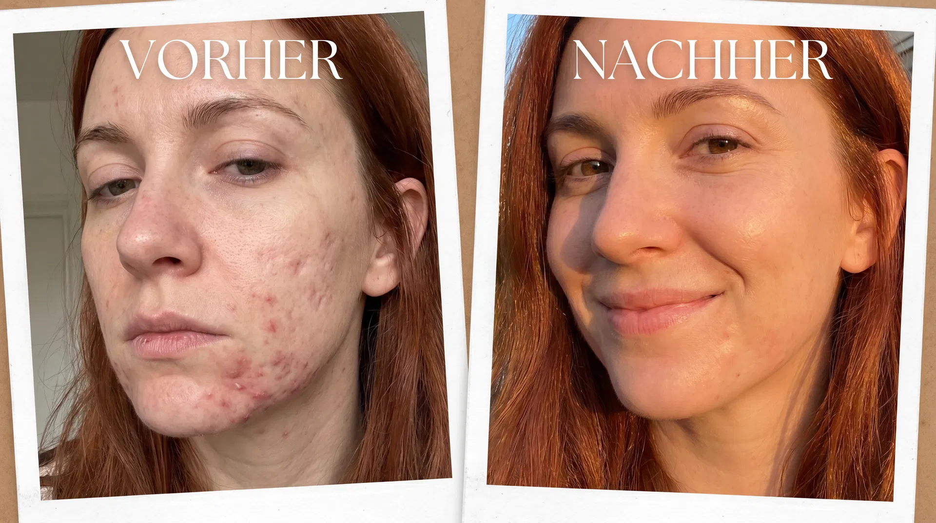 Vorher Nachher Katharina, 30