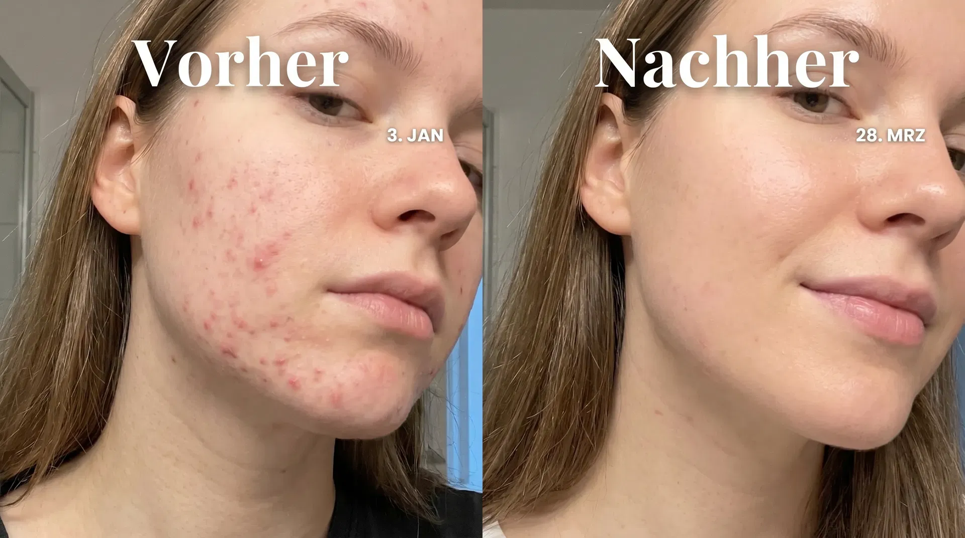 Vorher Nachher Tina, 22