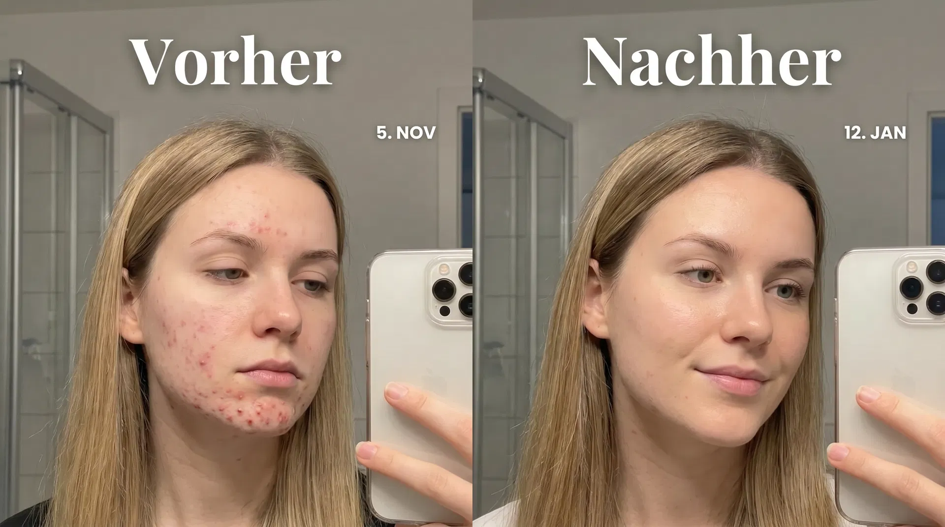 Vorher Nachher Paulina, 23