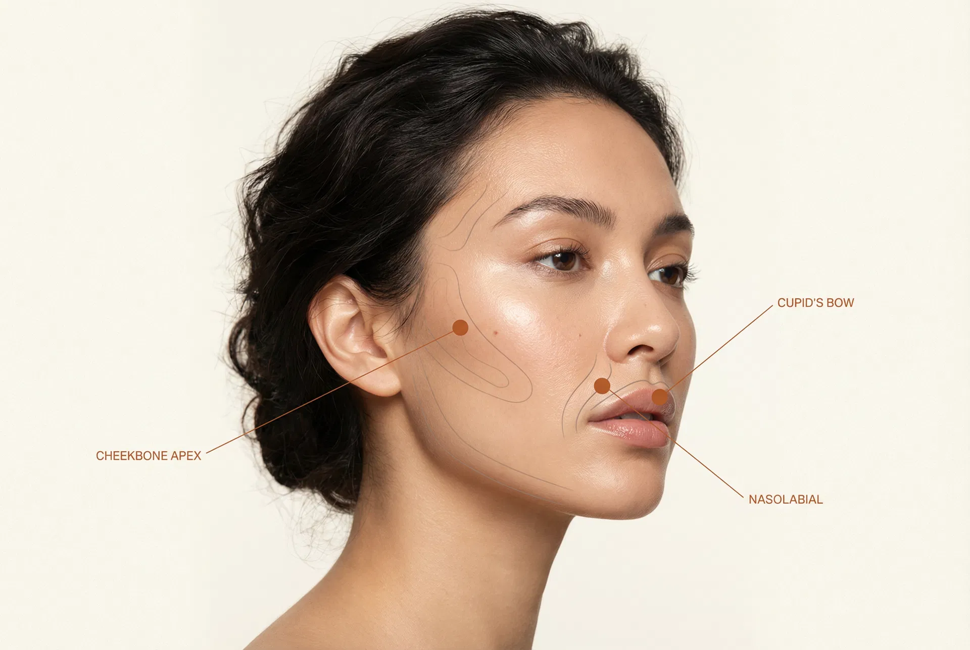 Medical aesthetics — Elevation Mark annotation on facial landmarks