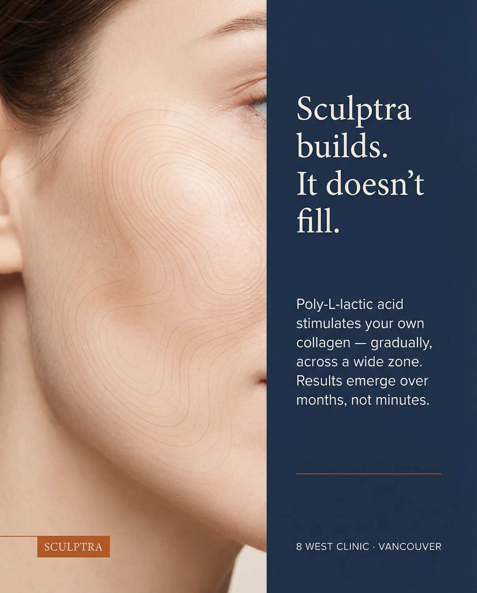 Post 01 — Sculptra Split Panel