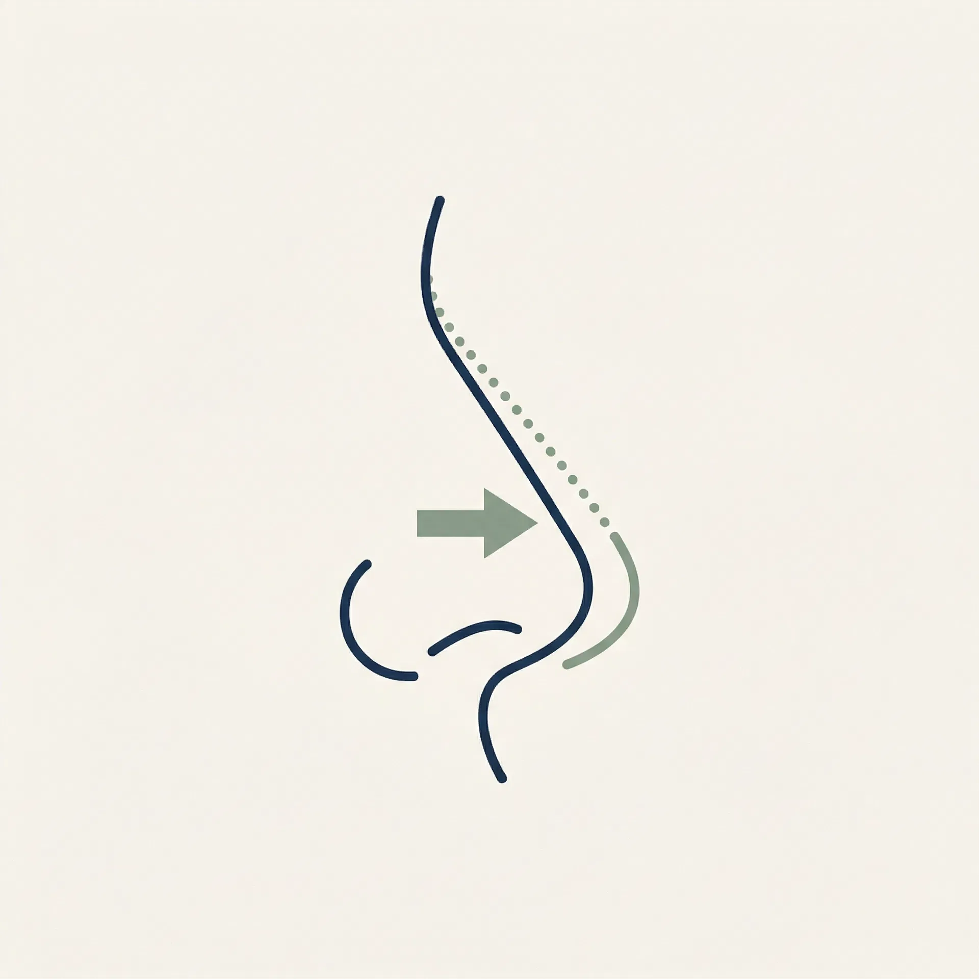 Deprojection illustration
