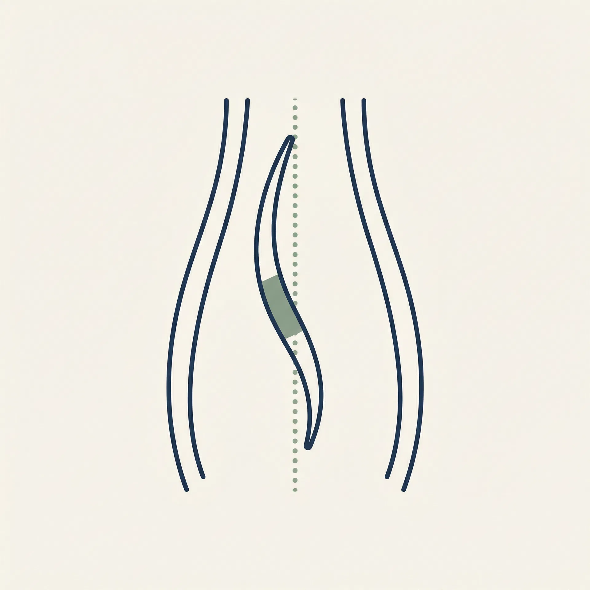 Septoplasty & Cartilage Harvest illustration