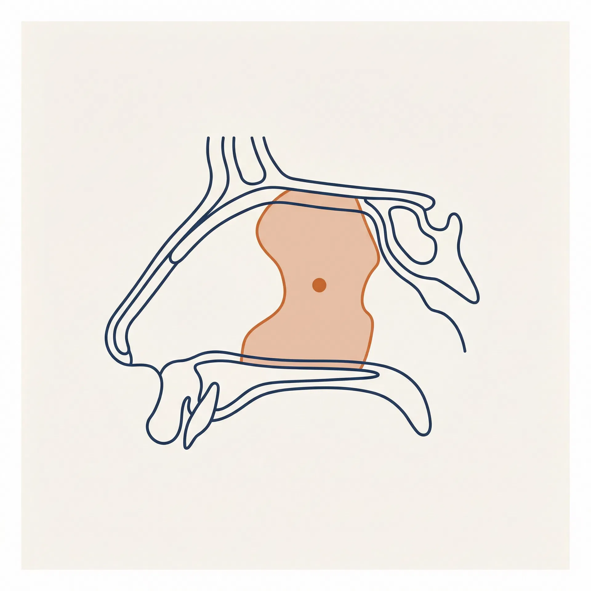 Septoplasty & Cartilage Harvest surgical diagram