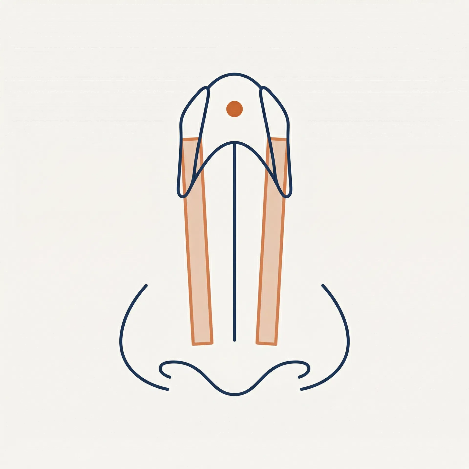 Spreader Grafts surgical diagram
