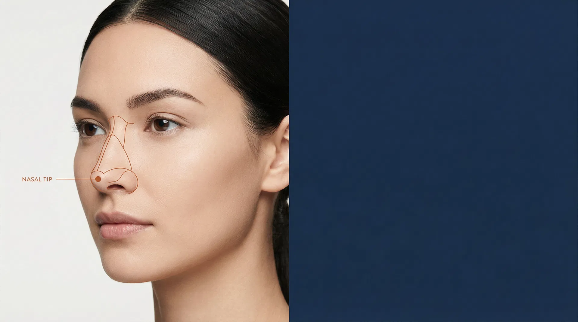Rhinoplasty techniques — patient with nasal annotation