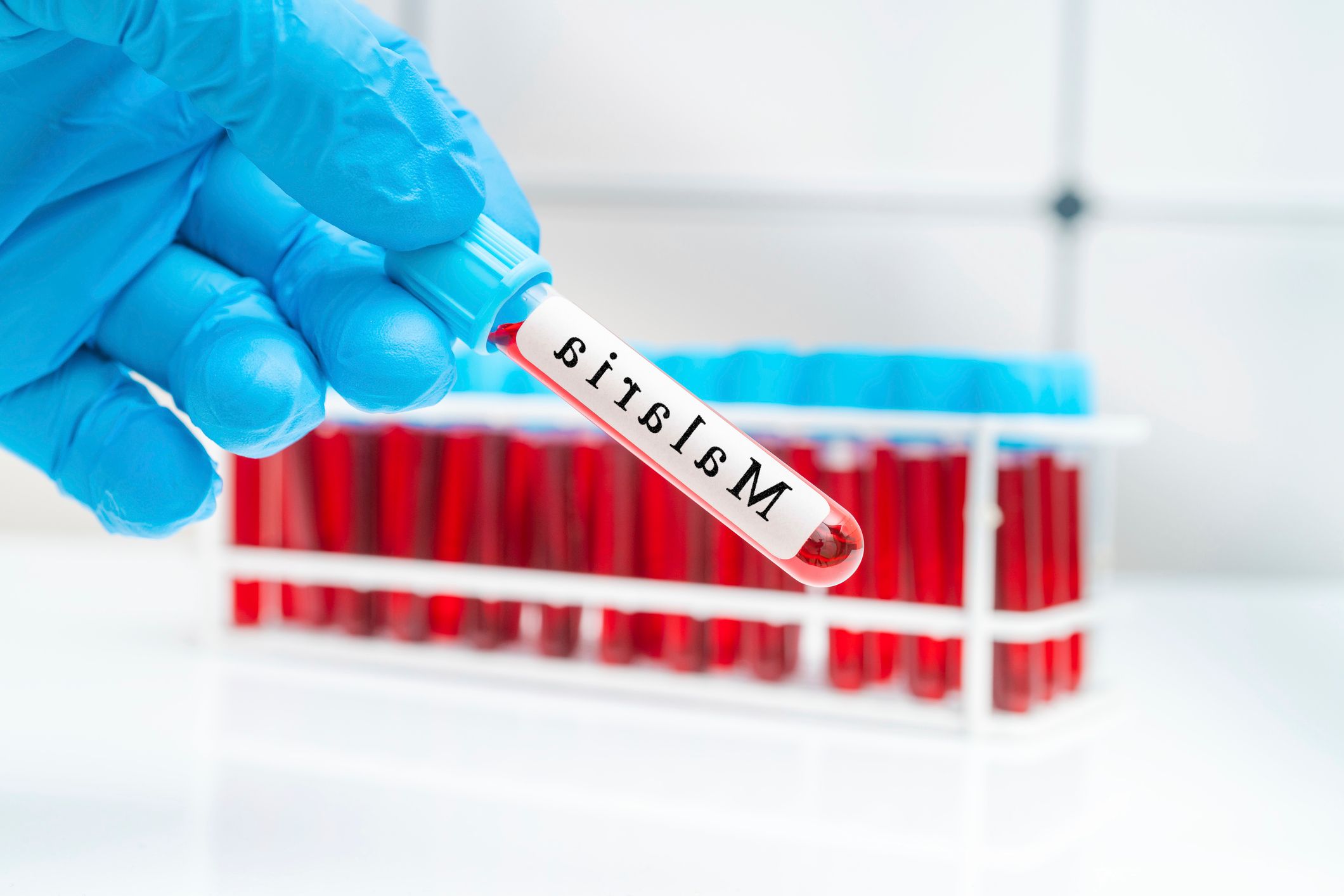 OMS aprobă istoric un medicament anti-malarie pentru bebeluși