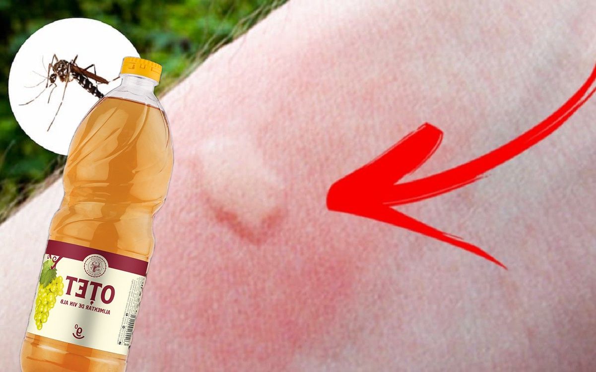 Oțetul, secretul rapid care calmează mâncărimile de țânțar. Remedii naturale eficiente!