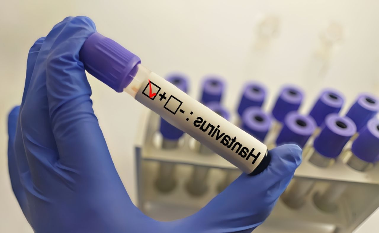 Australienii de pe nava cu hantavirus, acasă și direct în carantină!