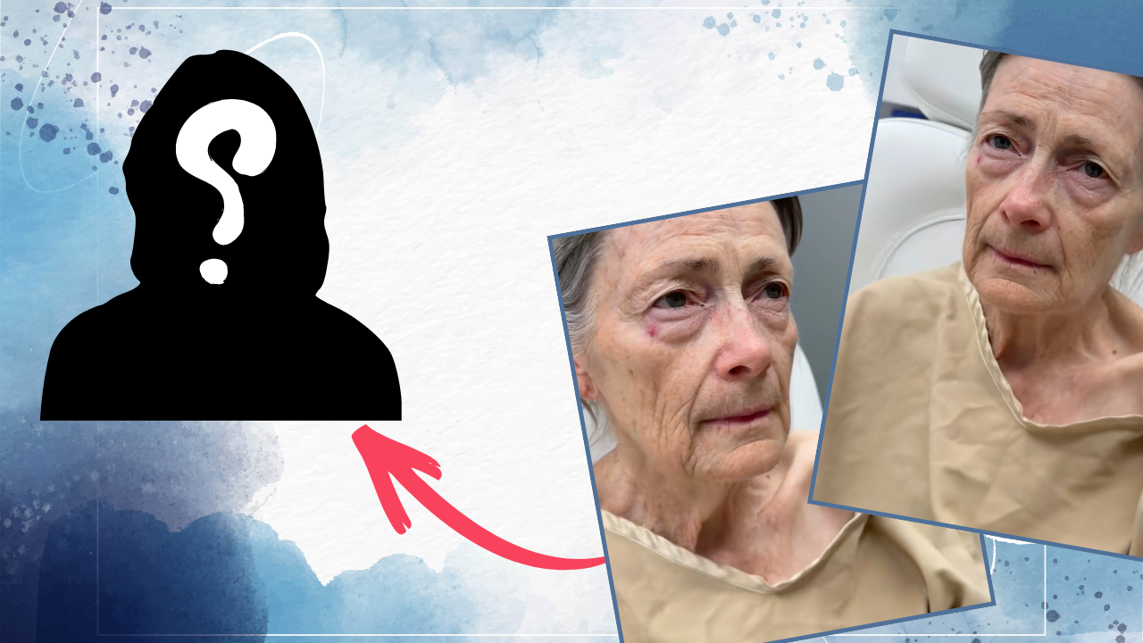 Faceliftul care a întinerit o femeie de 70 de ani cu 30 de ani: "Voi spune că am 40!"