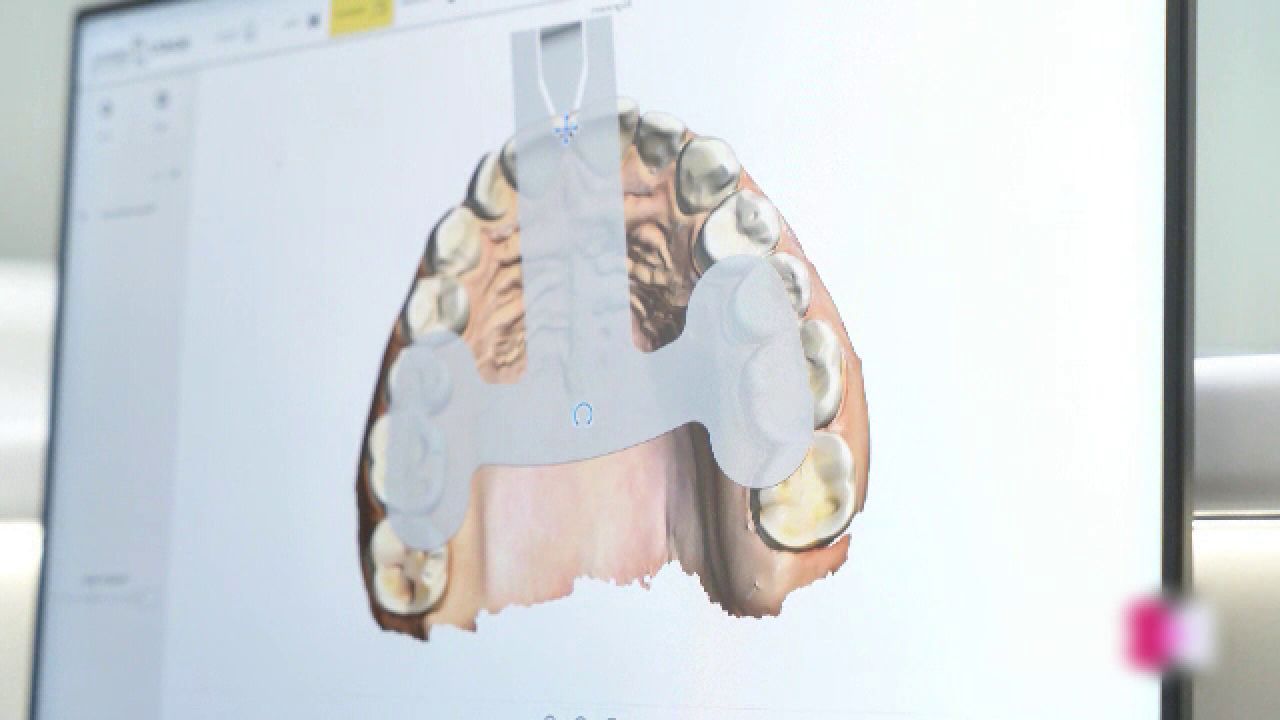 AI revoluționează stomatologia: Tratamente mai rapide, precise și complet digitale