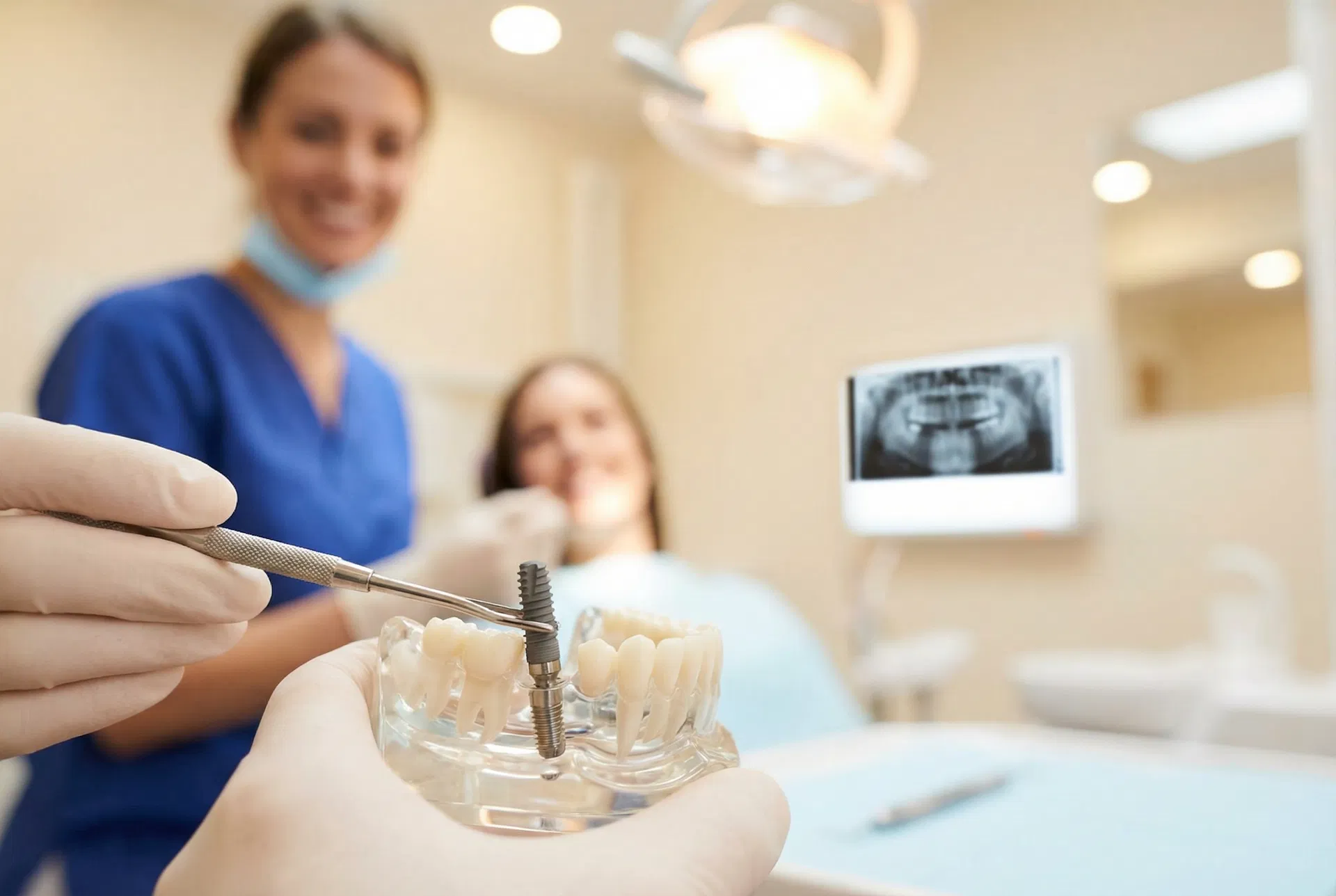 Dental Implants
