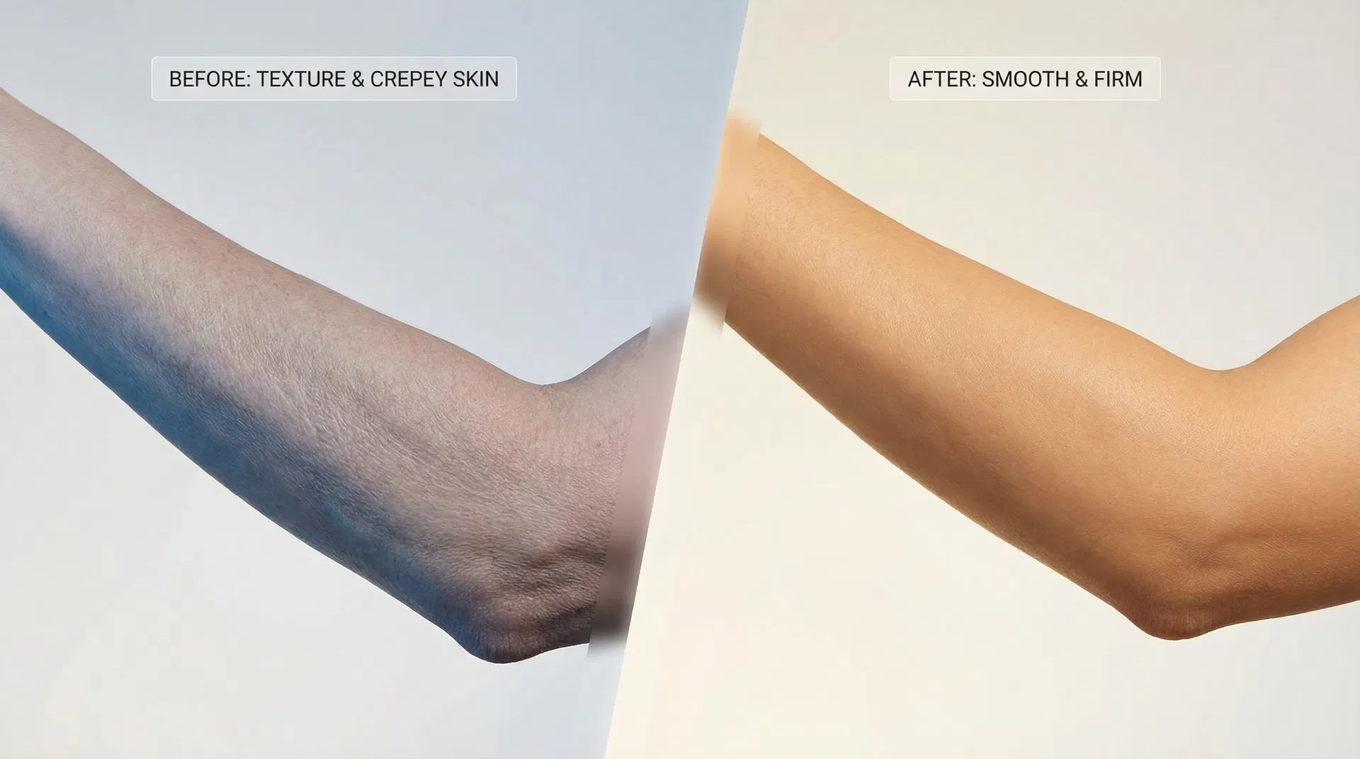Skin transformation timeline