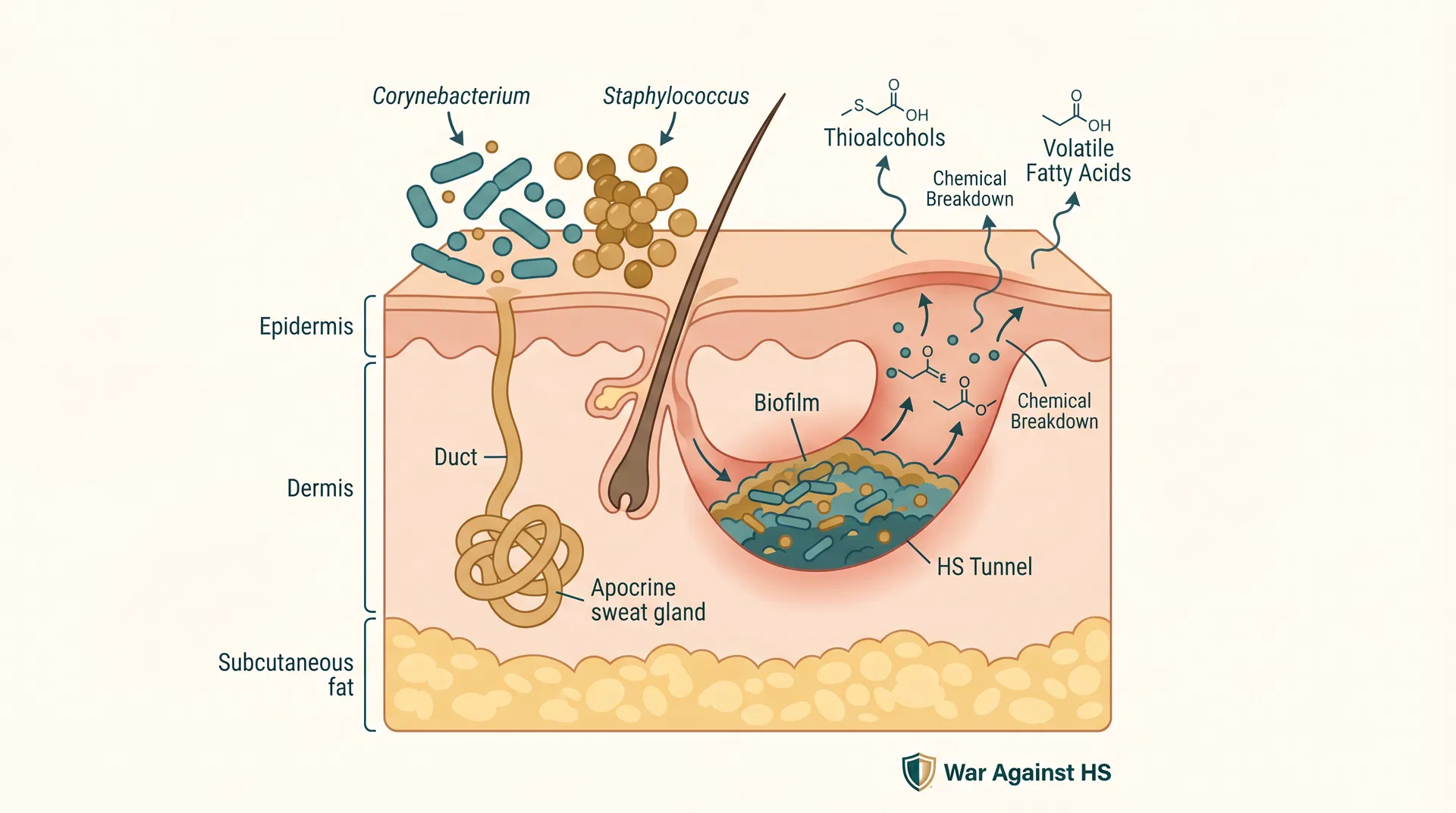 Cross-section of skin showing apocrine glands, bacterial colonies including Corynebacterium and Staphylococcus, and biofilm formation in HS tunnels