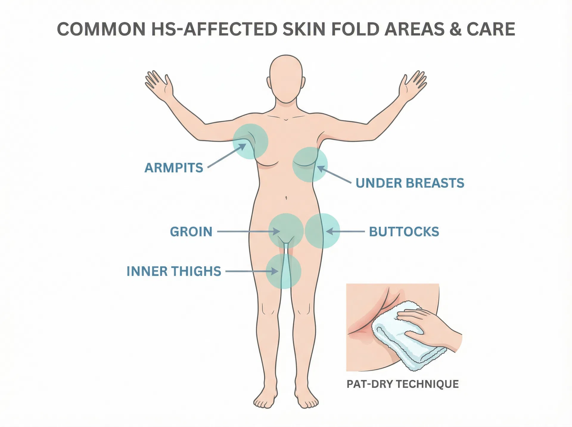 Anatomical diagram showing common HS-affected skin fold areas and the pat-dry technique