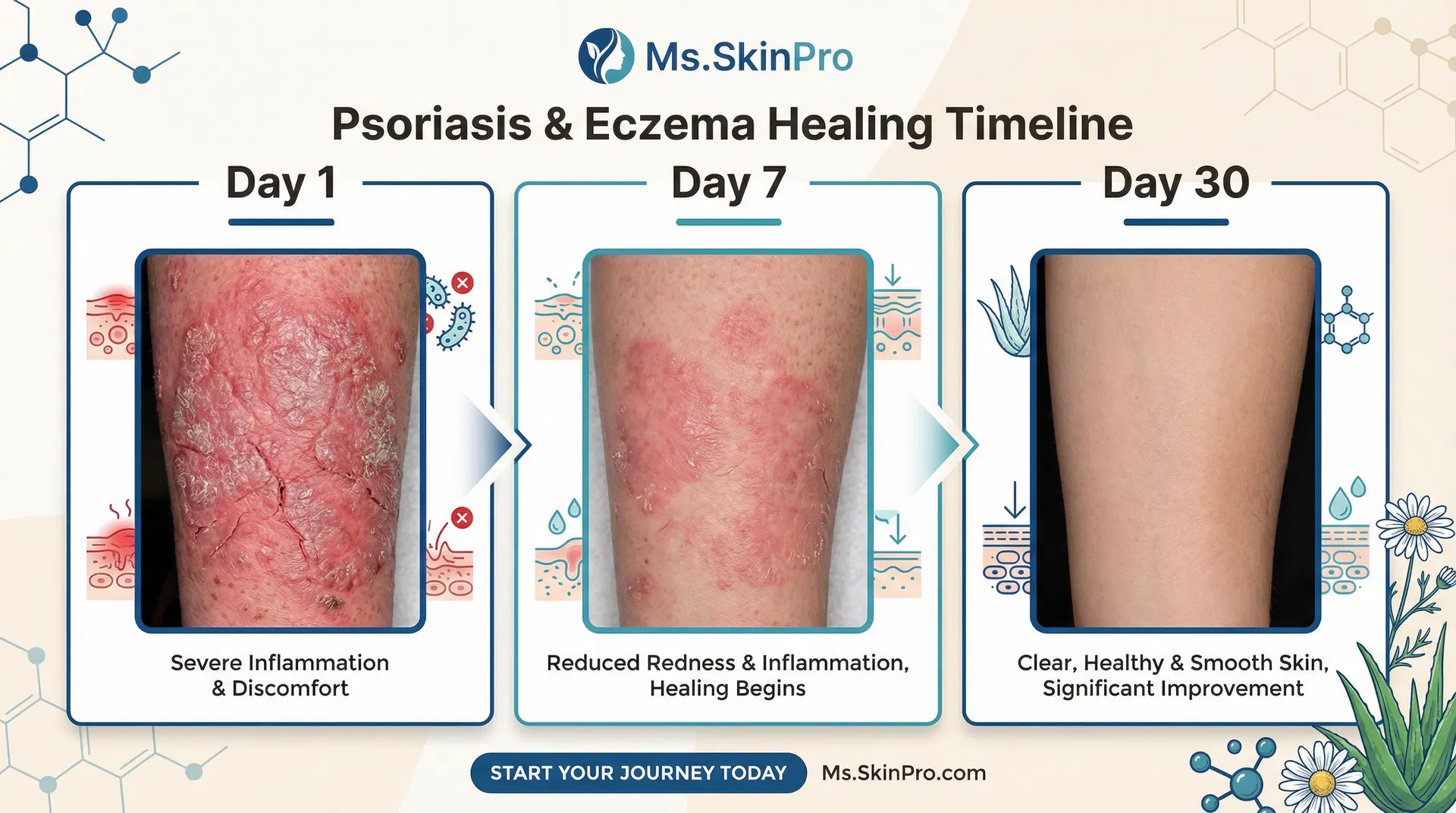 Ms.SkinPro Treatment Progress - Day 1 to Day 30