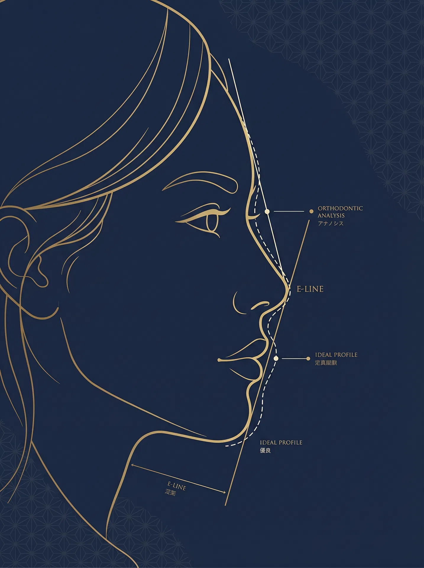 E-Line 横顔の分析図