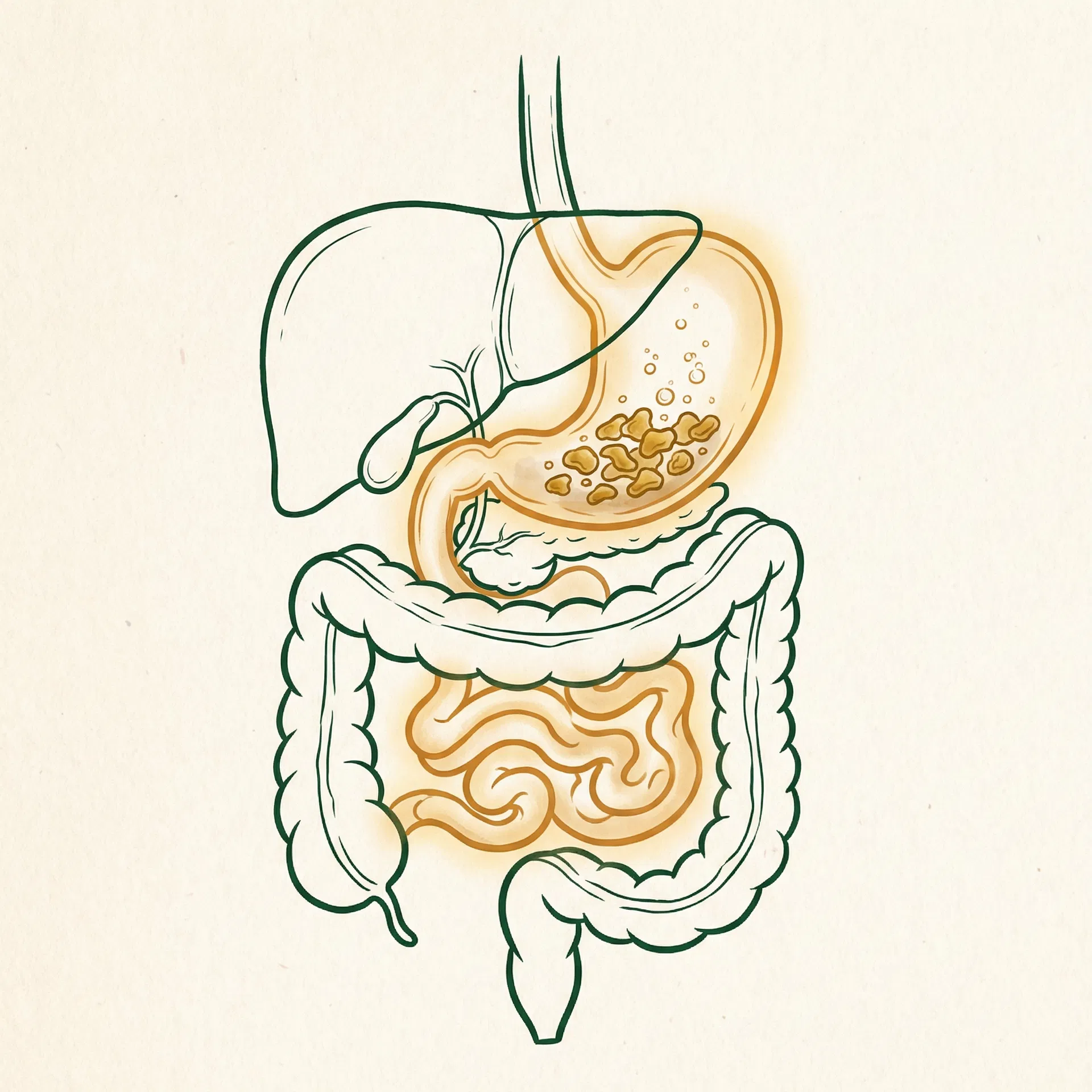 Illustration of the digestive system showing food sitting stagnant in the stomach