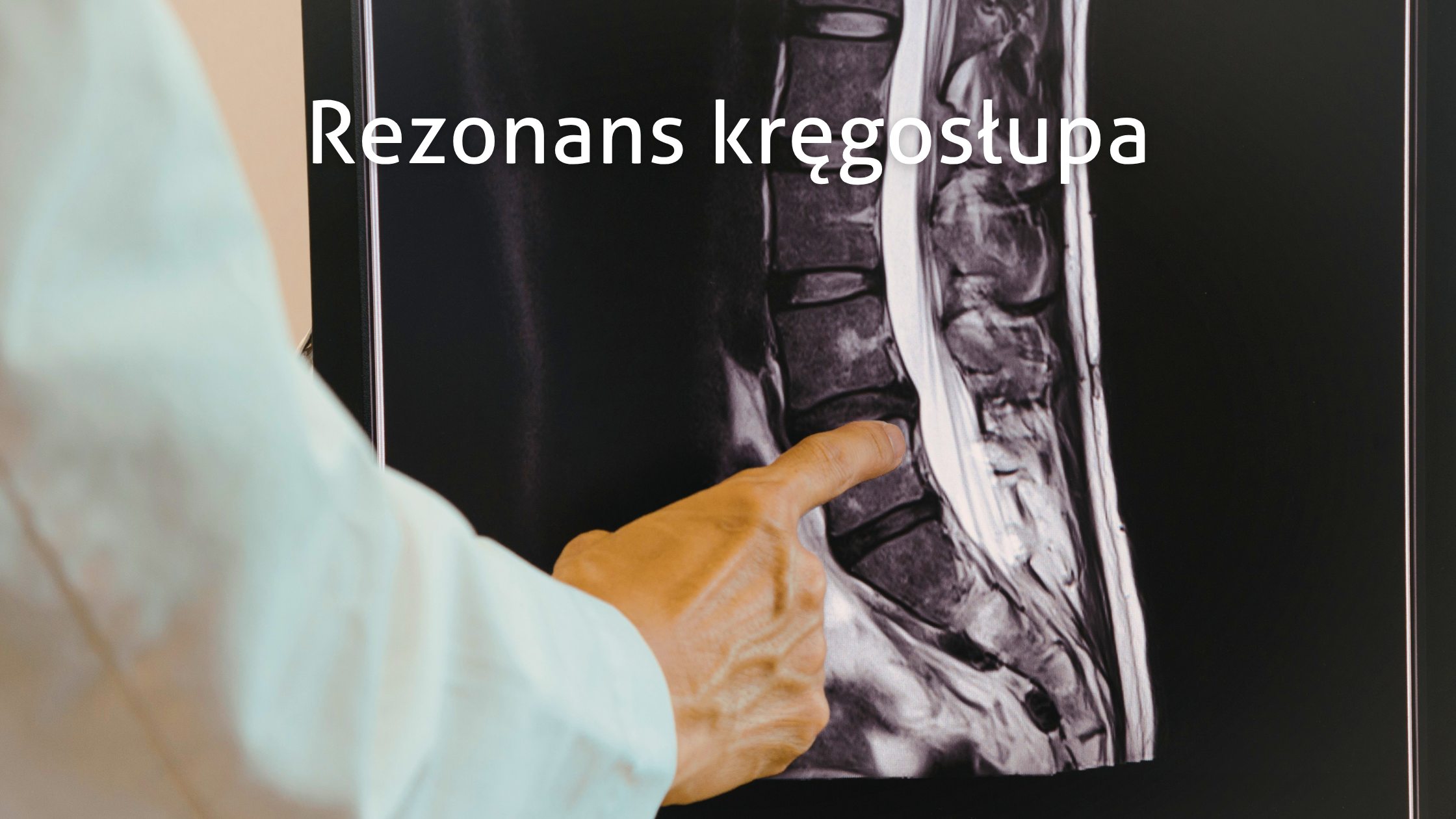 Ból kręgosłupa i rezonans magnetyczny. Kiedy badanie naprawdę ma sens