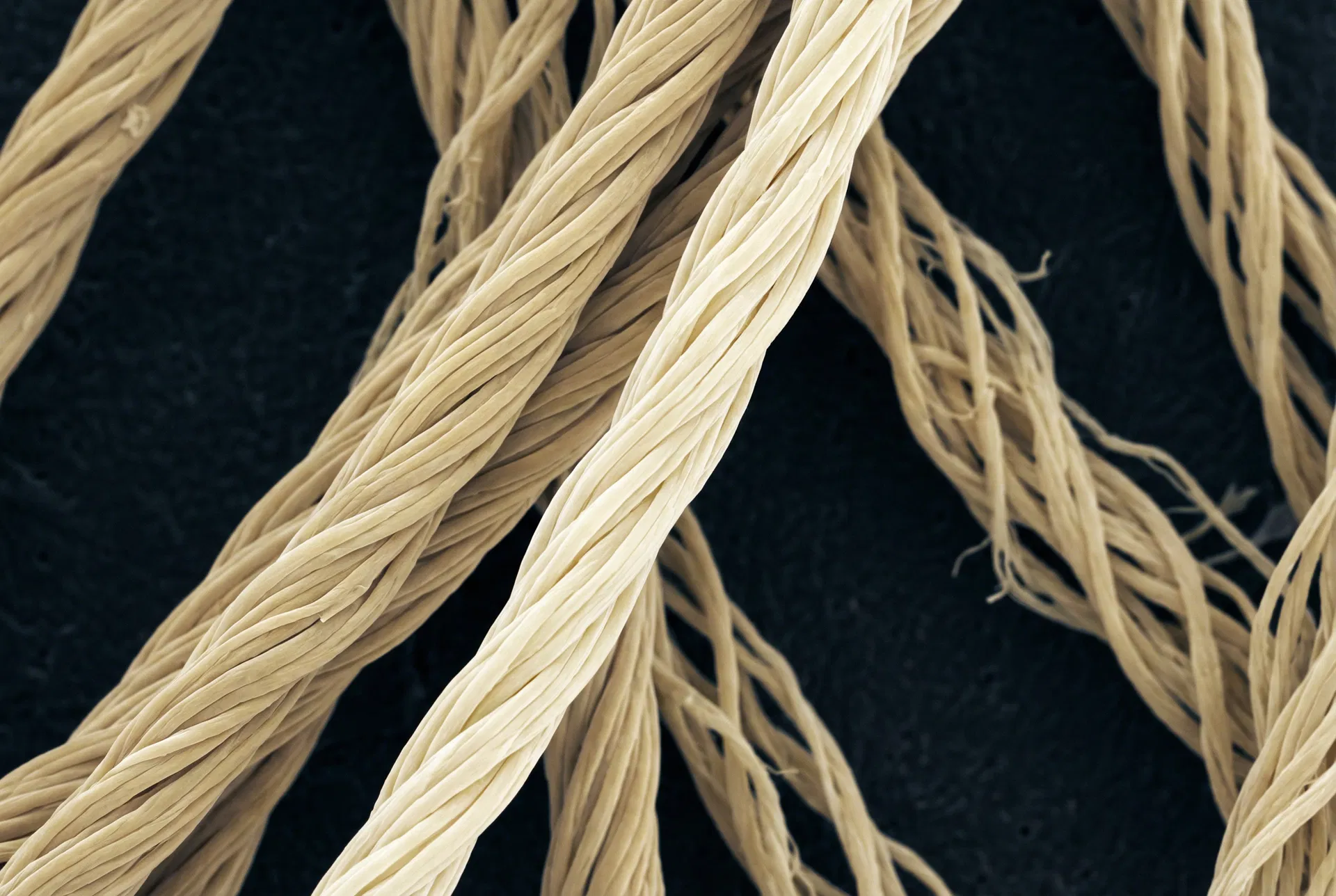Electron microscopy image of collagen fibre bundles in the dermis