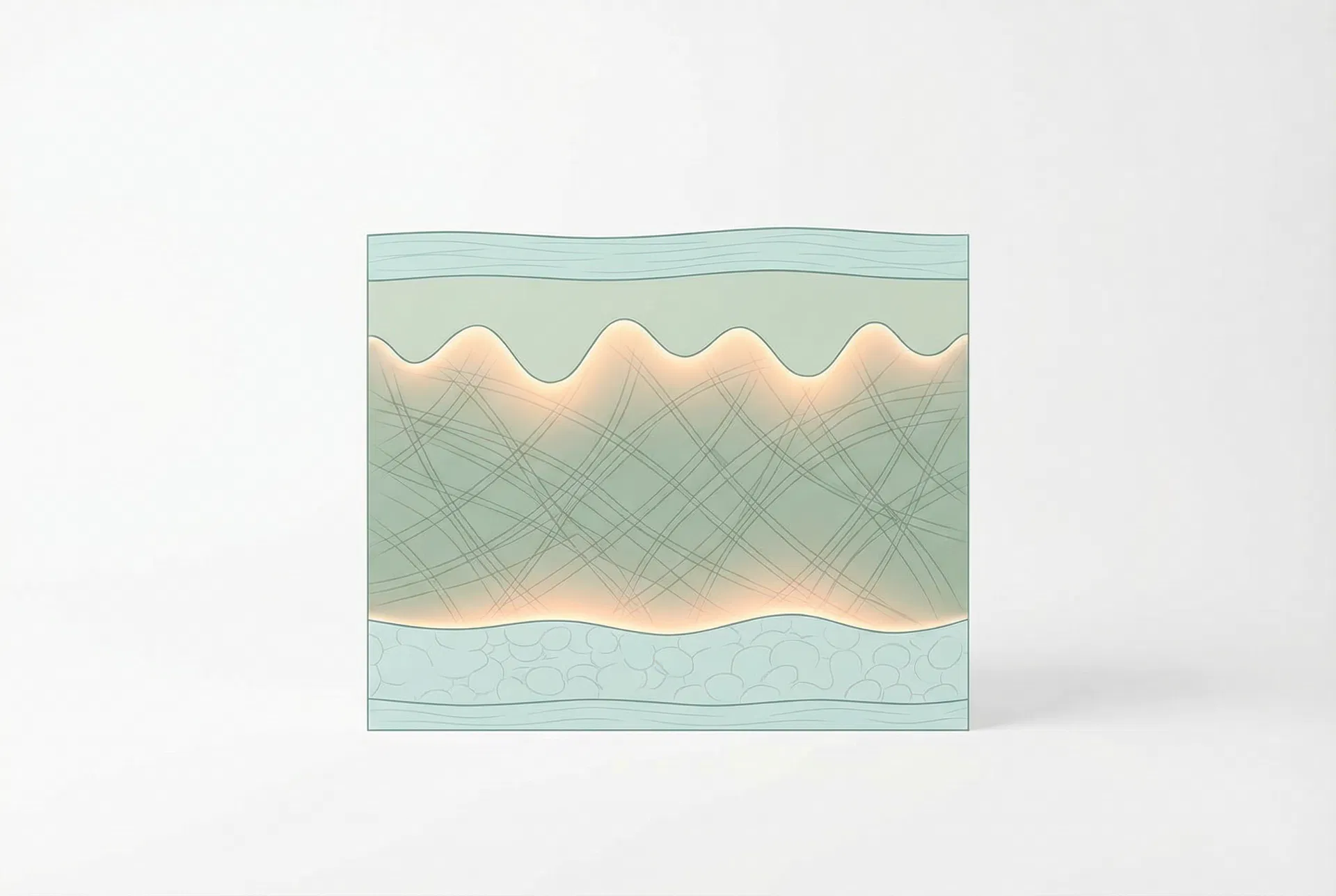 Cross-section illustration of skin layers showing RF target zone in the dermis