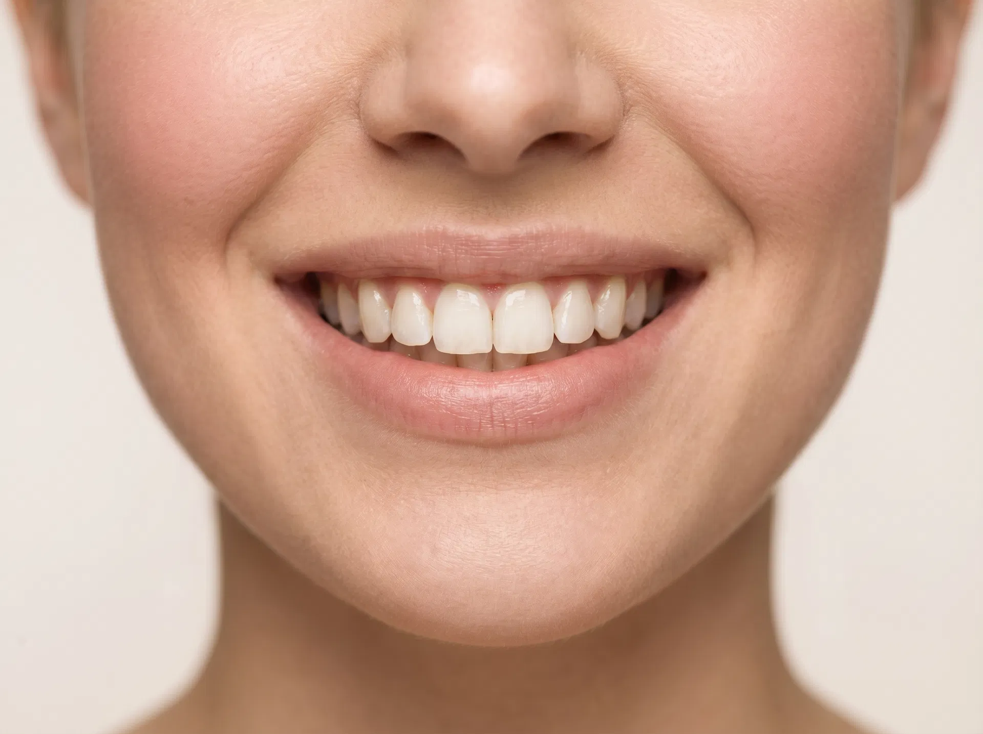 Shape balancing after filler smile example