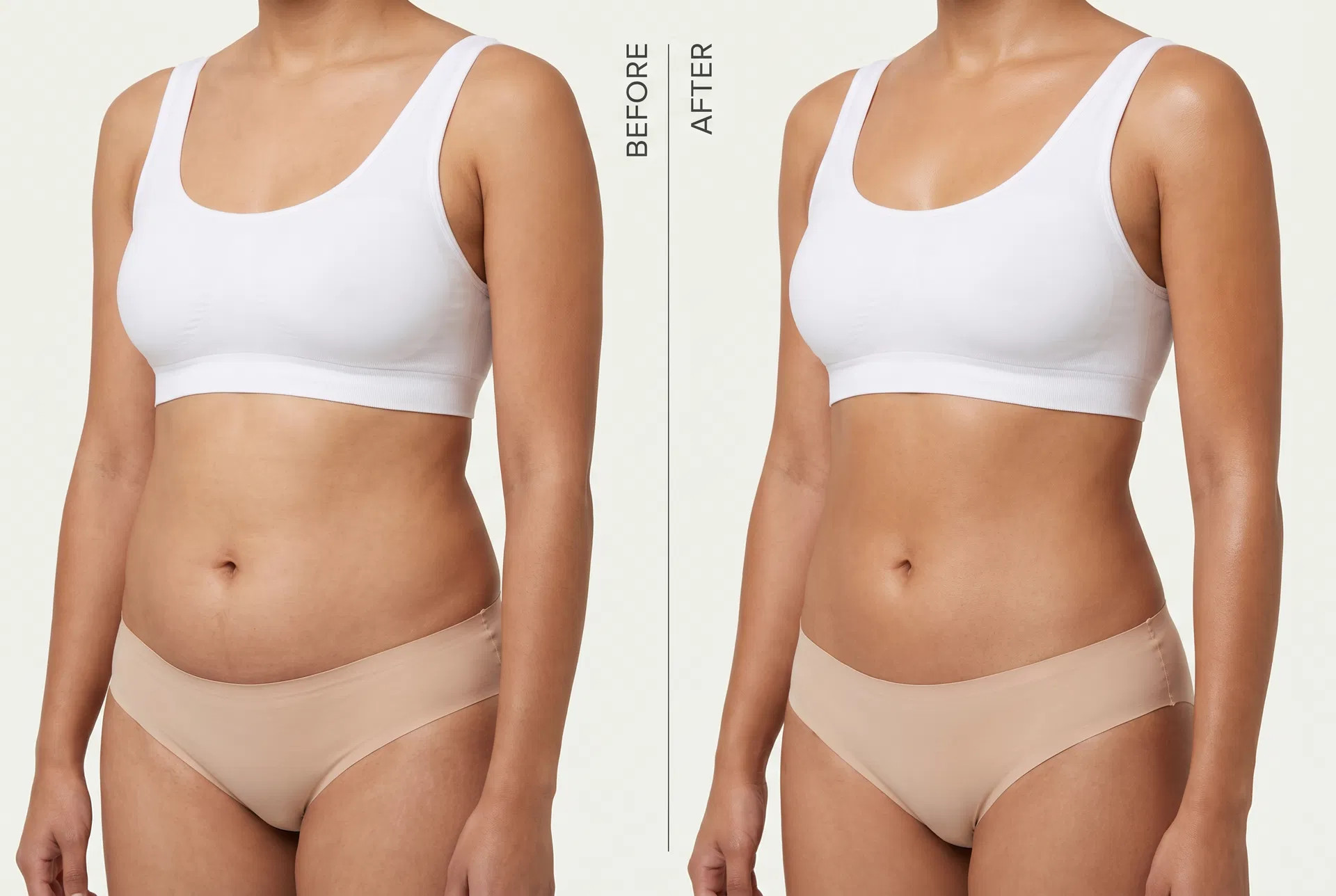 Abdomen — before and after results with the ZENN SculptRoll