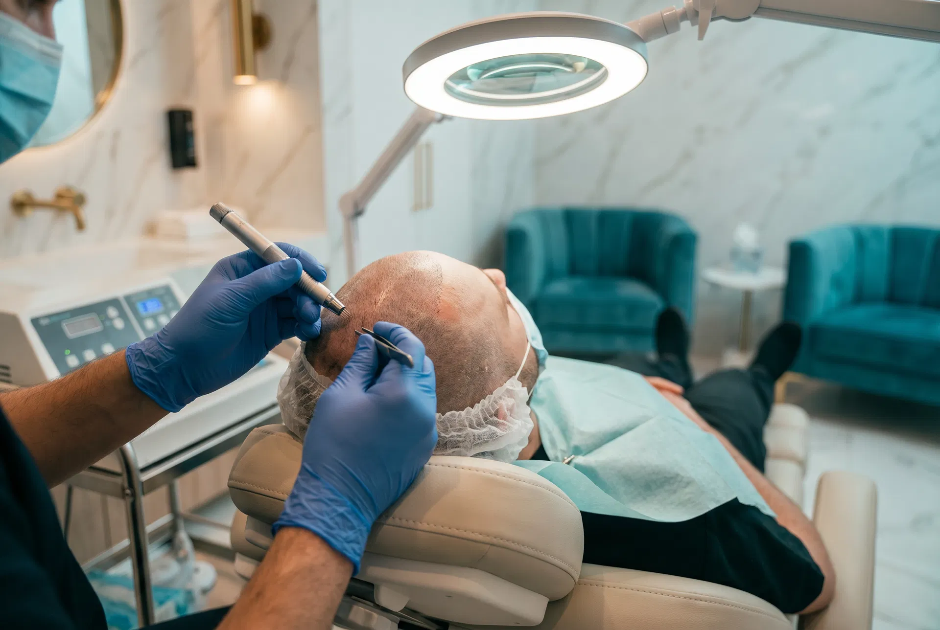 Hair Transplant (FUE)