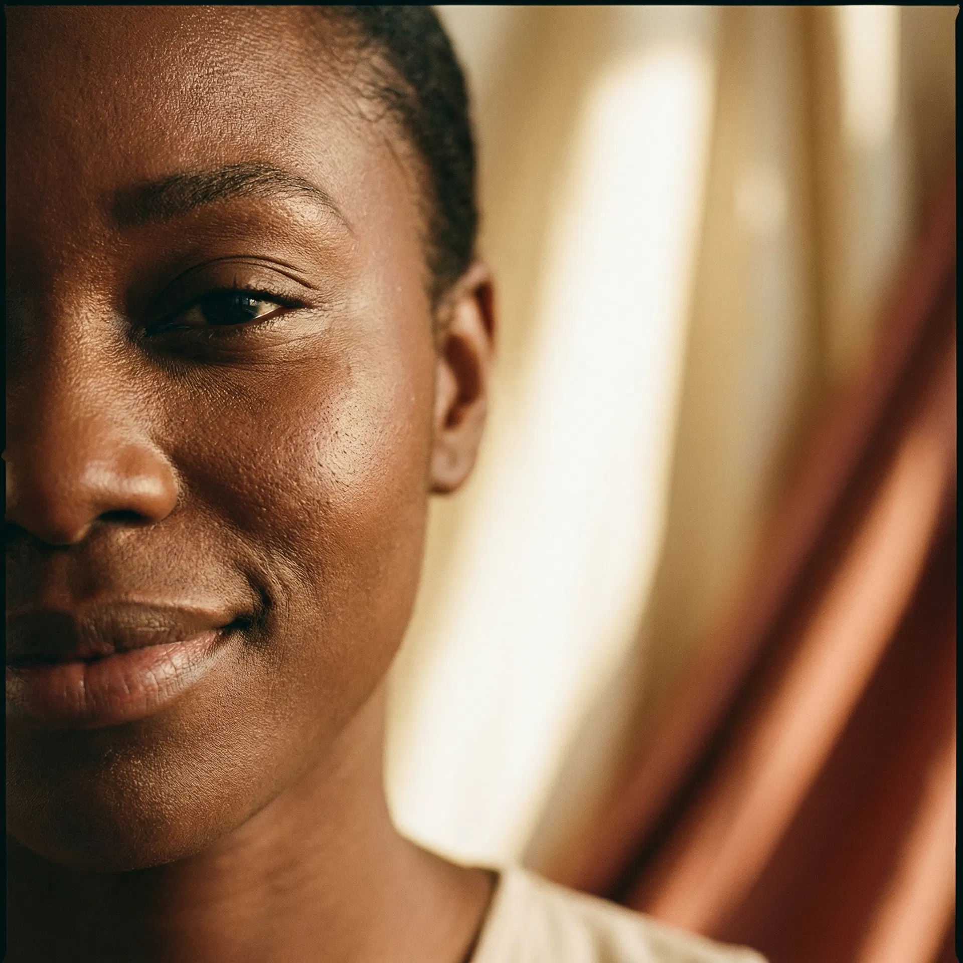 Acne Scarring & Texture