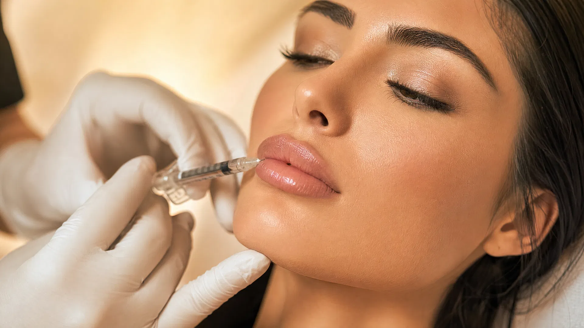Lip filler treatment at Annayah Aesthetics Brighton skin clinic