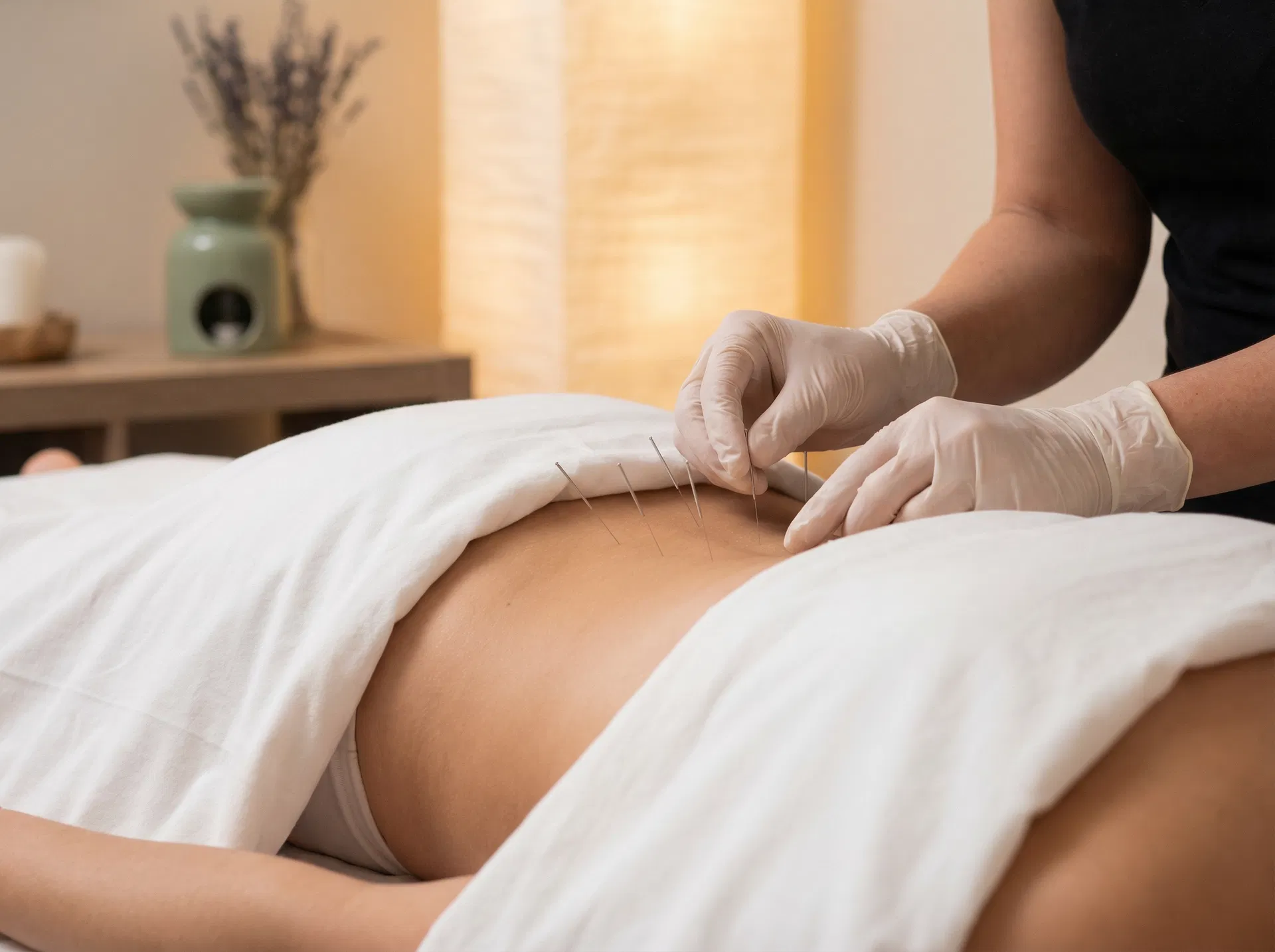 Fertility acupuncture treatment for natural conception support