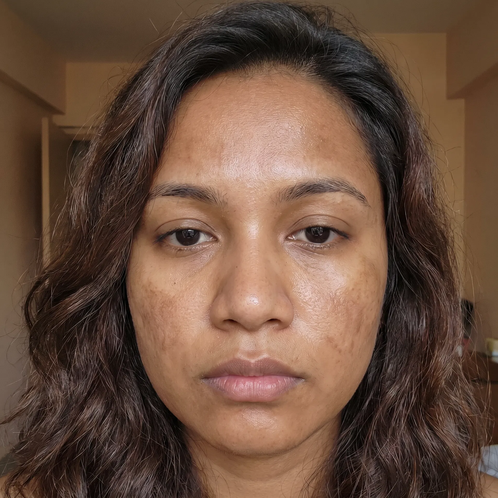 Filipino-Indian woman tired of uneven skin