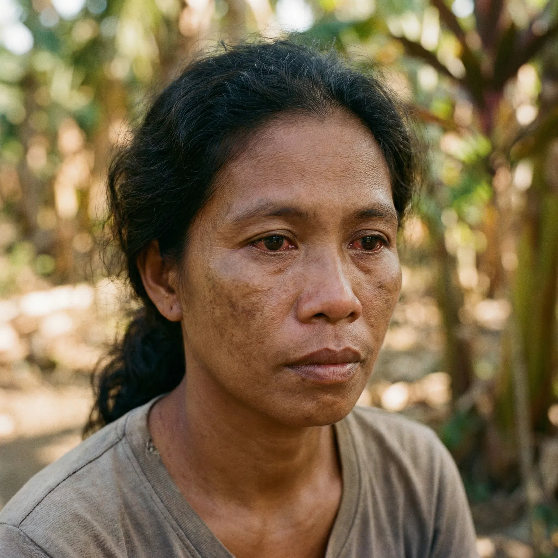 Morena woman with melasma and uneven skin tone