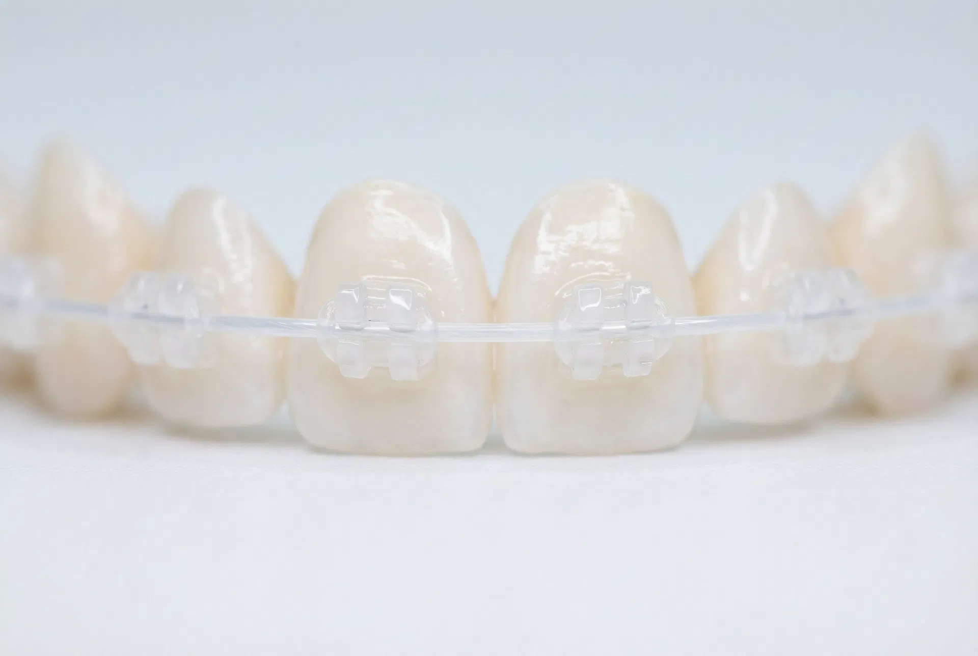 Traditional Metal Braces