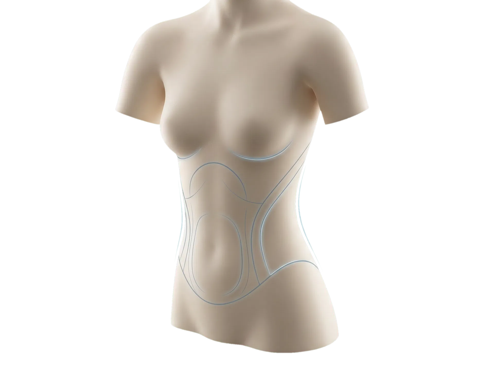 Illustrasjon av typiske behandlingsområder for kroppskonturering