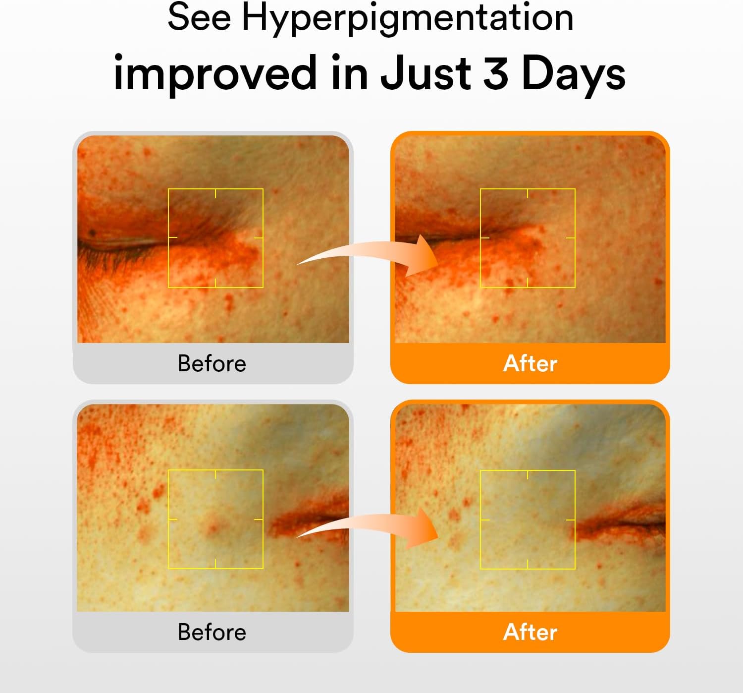 Abib Glutathiosome Dark Spot Serum Vita drop 1.69 fl.oz. | Korean Skincare, Dark Spot, Hyperpigmentation Treatment | Serum for Sensitive, Uneven Skin 5