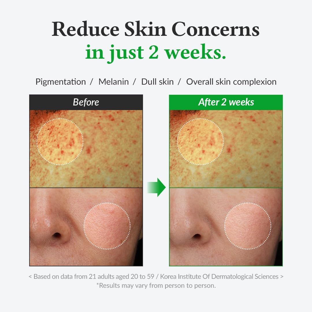 Dr.Althea Gentle Vitamin C Serum | Benefits Skin Tone and Pigmentation | Gentle on Skin For Even Skin Tone | Korean Vegan Skincare for All Skin Types (Gentle Vitamin C) 4