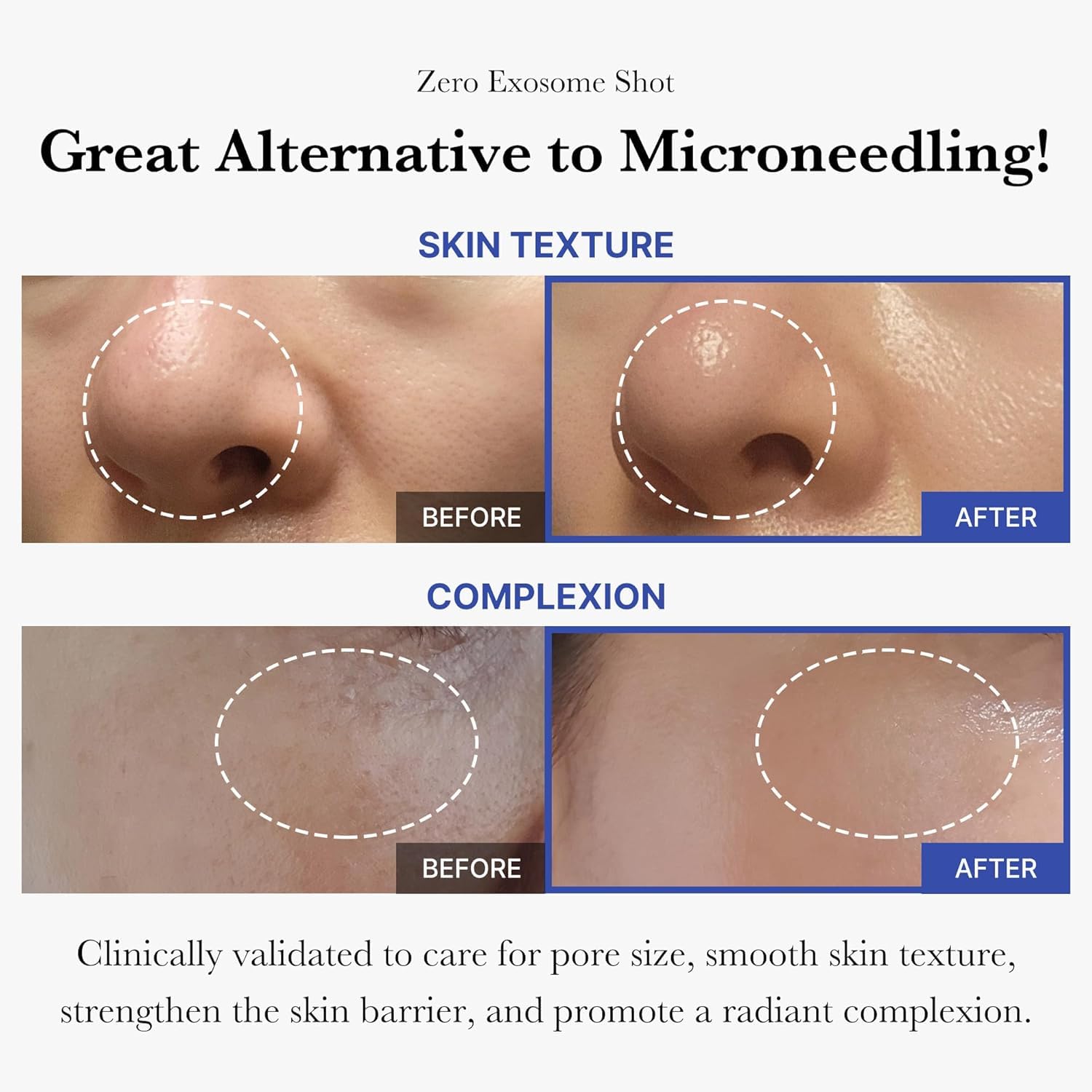 Medicube Zero Exosome Shot Spicule Serum | Liquid Skin Booster with Exosome & AHA+BHA+PHA | Pore Care & Skin Texture Refining Serum | Korean Skincare, 30ml 3