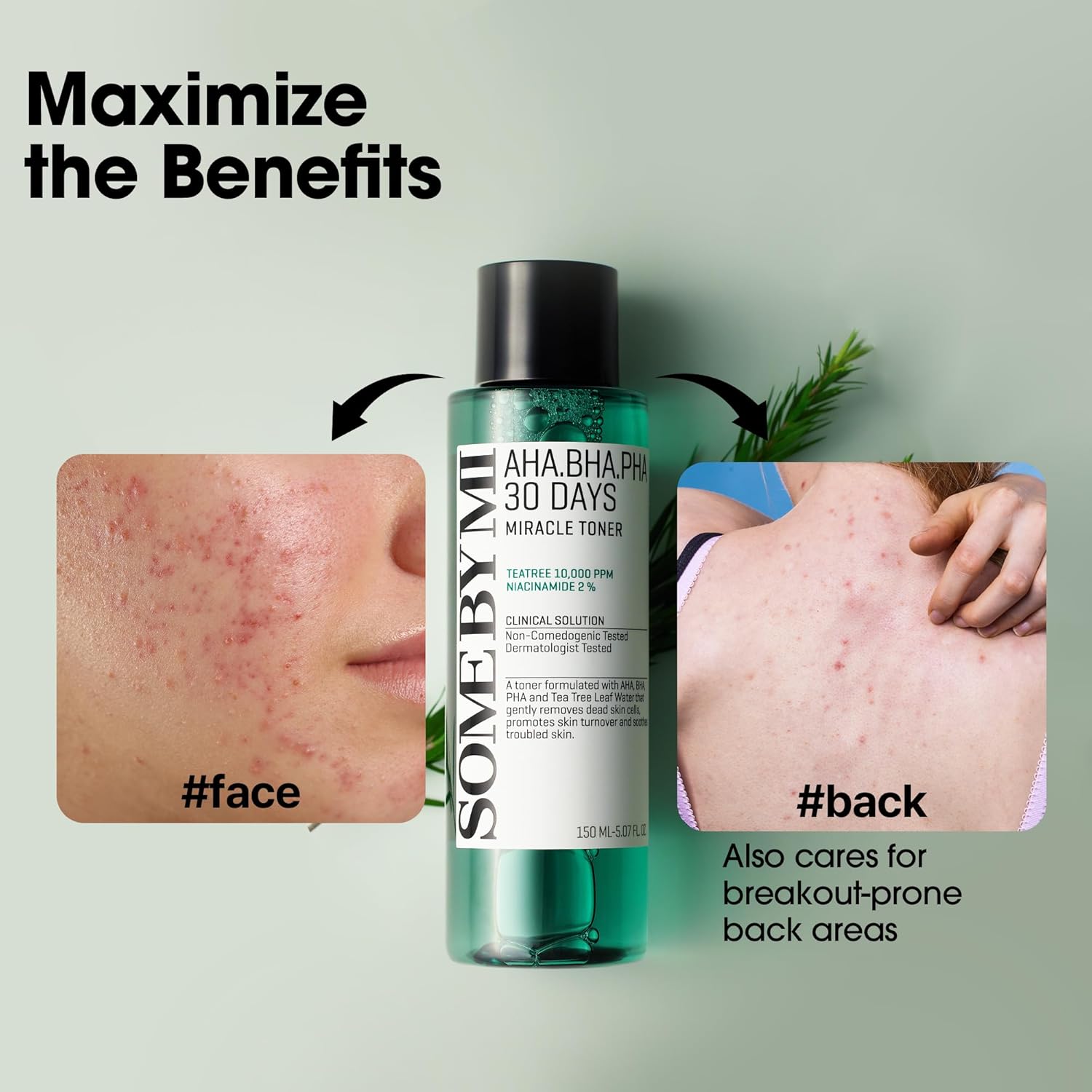 Some By Mi AHA-BHA-PHA 30 Days Miracle Face Toner | 150ml 2